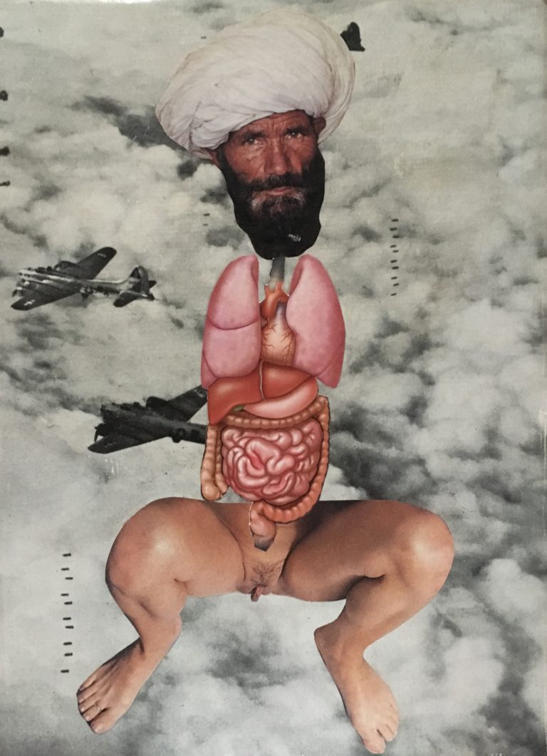 art 5